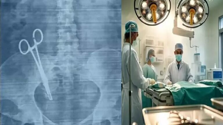 17 साल बाद महिला के पेट से निकाली गई कैची, KGMU के डॉक्टरों ने बचाई जान