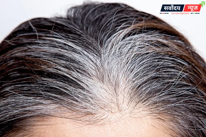 सफेद बाल सिर्फ 15 दिन में होंगे काले! जानिए 5 सबसे असरदार घरेलू नुस्खे