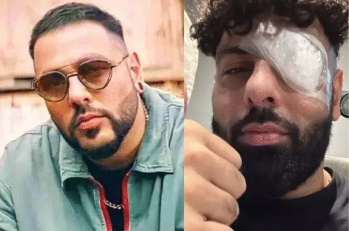 बादशाह की आंख में लगी चोट,'बैड्स ऑफ बॉलीवुड' से कनेक्शन? जानिए पूरा मामला