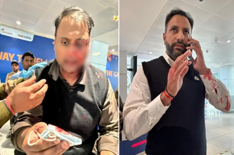 दिल्ली एयरपोर्ट पर पायलट और यात्री के बीच ‘खूनी फाइट’, पायलट ने 7 साल की बेटी के सामने यात्री को किया लहूलुहान,सस्पेंड..