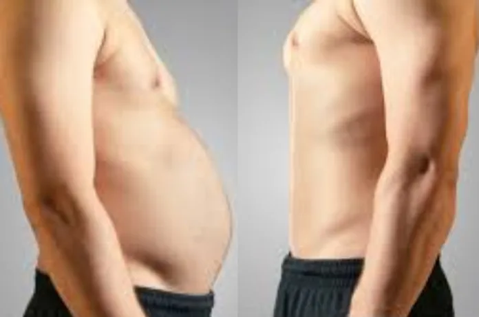 आंवला के साथ इसका काढ़ा बना कर पिने से घट सकता है मोटापा, आचार्य बालकृष्ण ने बताया सेवन का सही तरीका