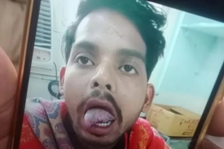पत्नी ने सोते हुए पति की जीभ काटी, गाजियाबाद में सनसनीखेज वारदात!