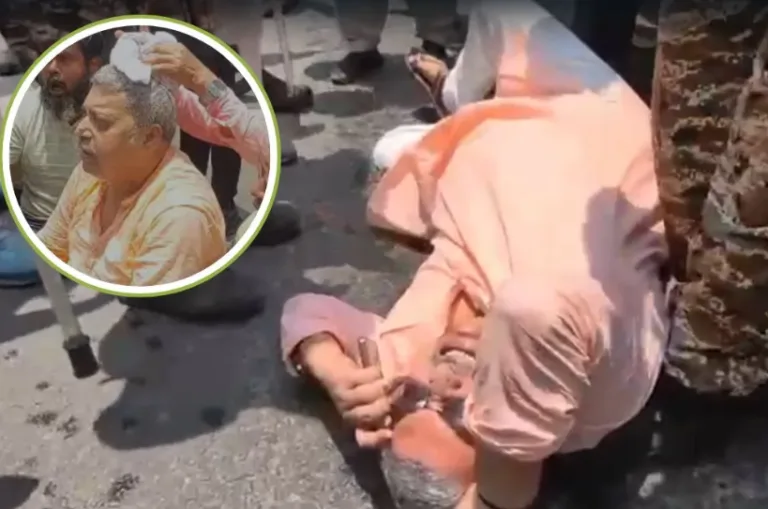 कोलकाता में टीएमसी सांसद कल्याण बनर्जी पर हमला, सिर में चोट; थाने के बाहर हुआ हंगामा